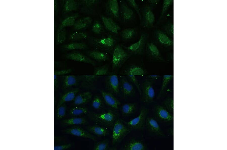 Immunofluorescence - Anti-AEBP1 Antibody (A88167) - Antibodies.com