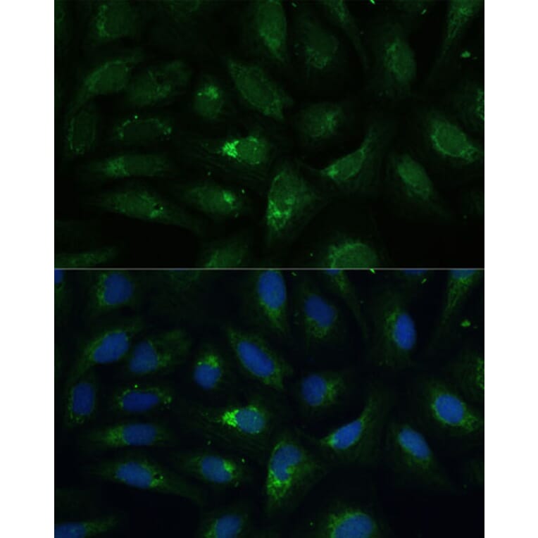 Immunofluorescence - Anti-AEBP1 Antibody (A88167) - Antibodies.com