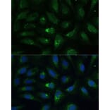Immunofluorescence - Anti-AEBP1 Antibody (A88167) - Antibodies.com