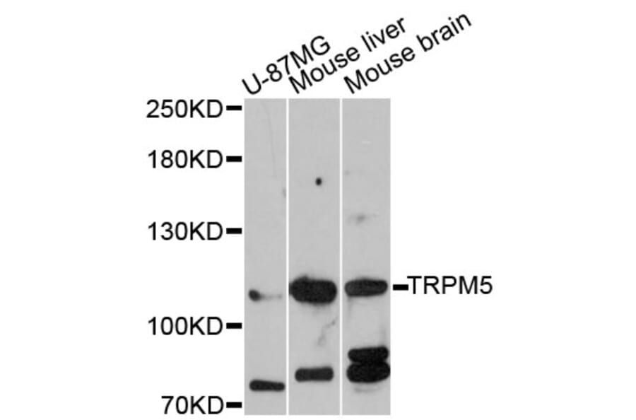 Western Blot - Anti-TRPM5 Antibody (A12365) - Antibodies.com