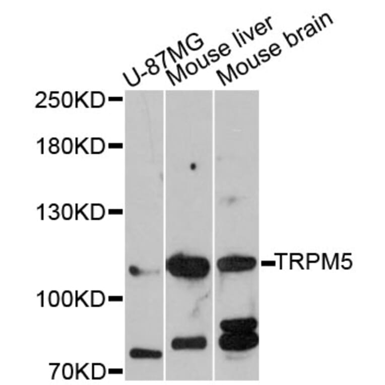 Western Blot - Anti-TRPM5 Antibody (A12365) - Antibodies.com