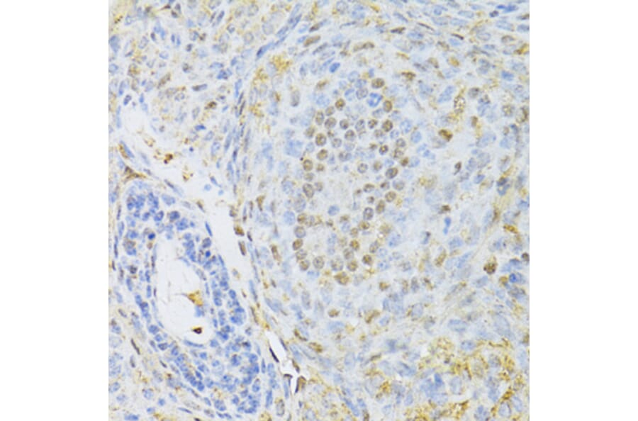 Immunohistochemistry - Anti-CTCF Antibody (A12562) - Antibodies.com