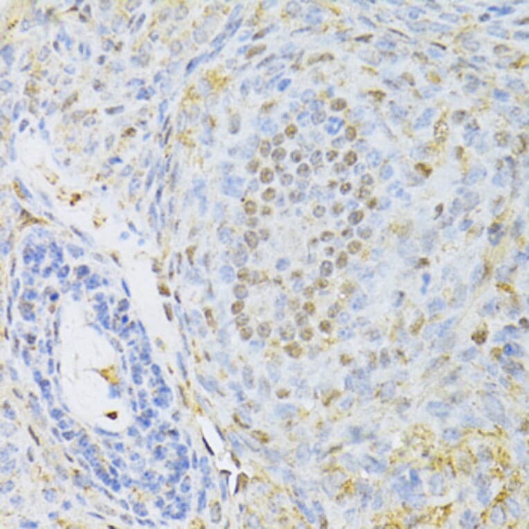 Immunohistochemistry - Anti-CTCF Antibody (A12562) - Antibodies.com