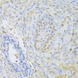 Immunohistochemistry - Anti-CTCF Antibody (A12562) - Antibodies.com