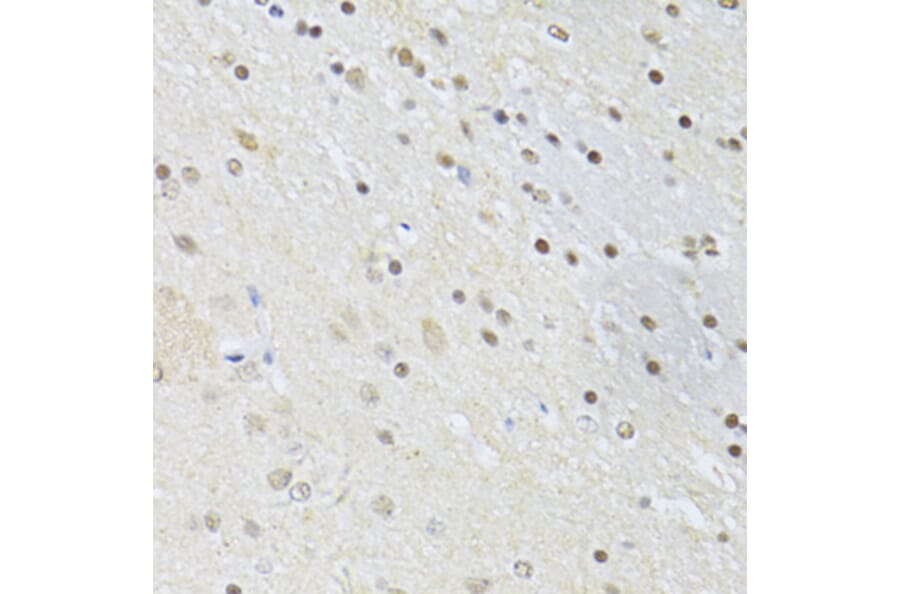 Immunohistochemistry - Anti-CTCF Antibody (A12562) - Antibodies.com