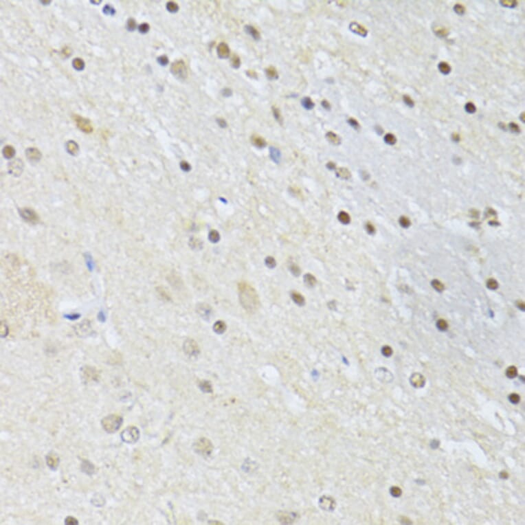 Immunohistochemistry - Anti-CTCF Antibody (A12562) - Antibodies.com