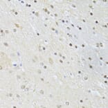 Immunohistochemistry - Anti-CTCF Antibody (A12562) - Antibodies.com