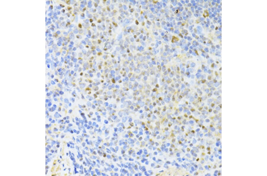 Immunohistochemistry - Anti-CTCF Antibody (A12562) - Antibodies.com