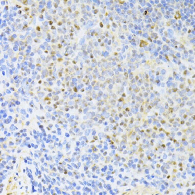 Immunohistochemistry - Anti-CTCF Antibody (A12562) - Antibodies.com