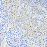 Immunohistochemistry - Anti-CTCF Antibody (A12562) - Antibodies.com
