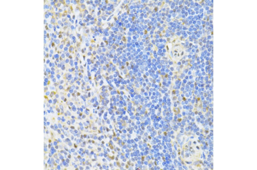 Immunohistochemistry - Anti-CTCF Antibody (A12562) - Antibodies.com