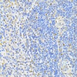 Immunohistochemistry - Anti-CTCF Antibody (A12562) - Antibodies.com