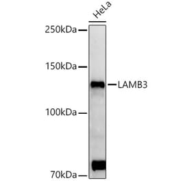 Western Blot - Anti-LAMB3 Antibody (A88170) - Antibodies.com