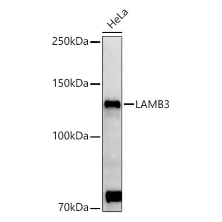 Western Blot - Anti-LAMB3 Antibody (A88170) - Antibodies.com
