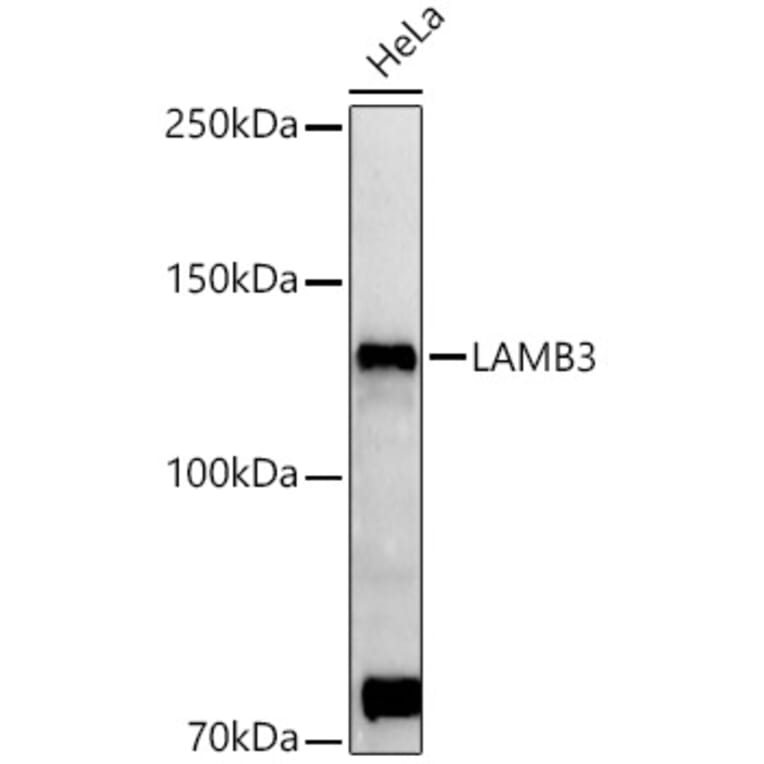 Western Blot - Anti-LAMB3 Antibody (A88170) - Antibodies.com