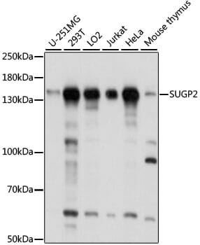 Western blot analysis of extracts of various cell lines, using Anti-SUGP2 Antibody (A15378) at 1:1,000 dilution.
Secondary antibody: Goat Anti-Rabbit IgG (H+L) (HRP) (AS014) at 1:10,000 dilution.
Lysates / proteins: 25µg per lane.
Blocking buffer: 3% non-fat dry milk in TBST.
Detection: ECL Basic Kit (RM00020).
Exposure time: 5s.