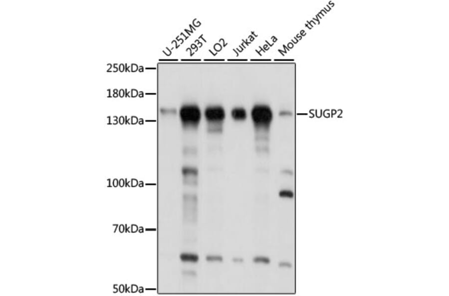 Western Blot - Anti-SFRS14/SUGP2 Antibody (A88171) - Antibodies.com