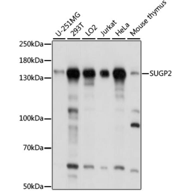 Western Blot - Anti-SFRS14/SUGP2 Antibody (A88171) - Antibodies.com
