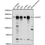 Western Blot - Anti-SFRS14/SUGP2 Antibody (A88171) - Antibodies.com