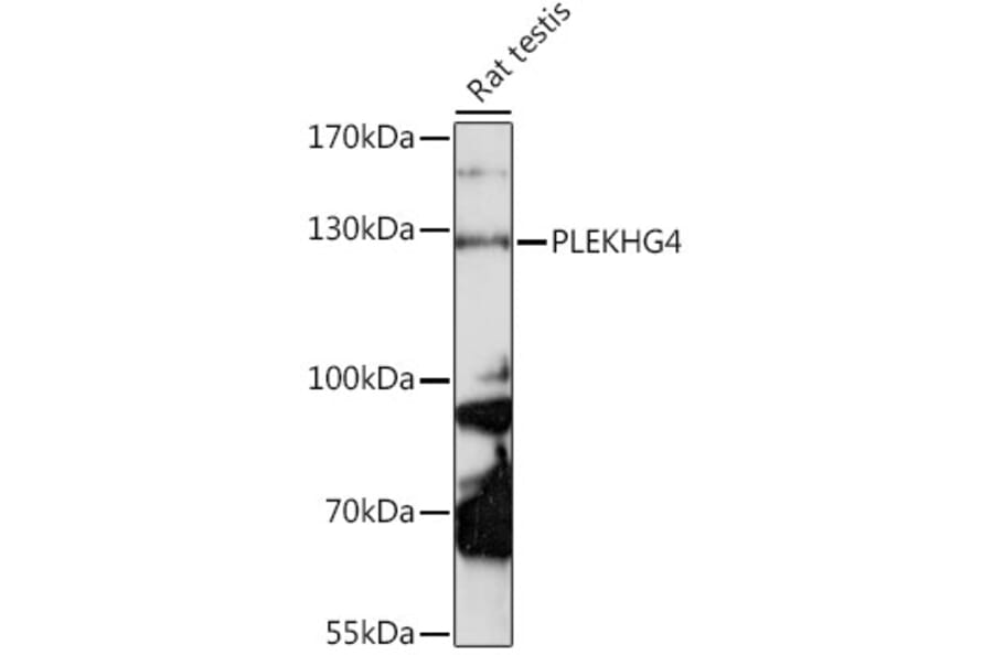 Western Blot - Anti-PLEKHG4 Antibody (A88172) - Antibodies.com