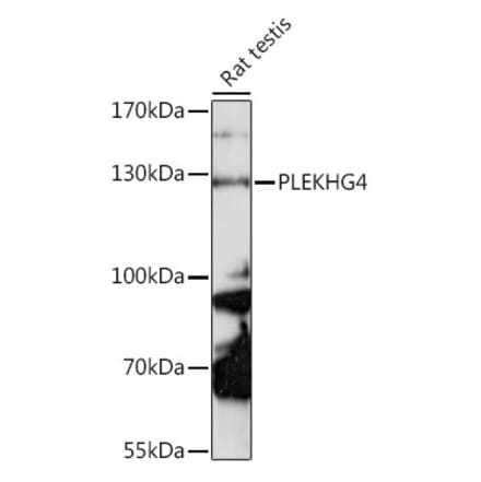 Western Blot - Anti-PLEKHG4 Antibody (A88172) - Antibodies.com