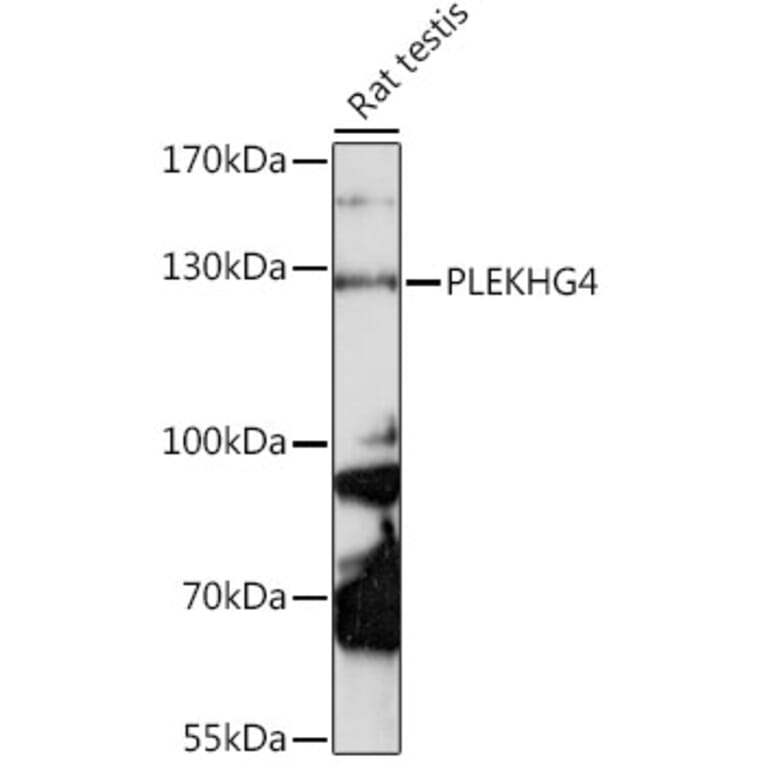 Western Blot - Anti-PLEKHG4 Antibody (A88172) - Antibodies.com