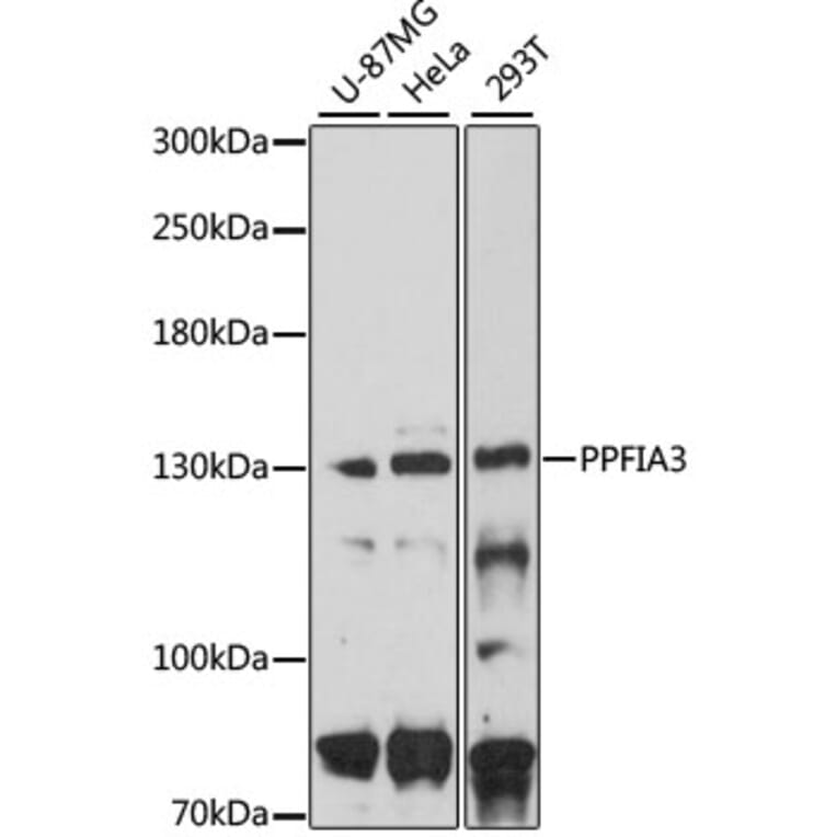 Western Blot - Anti-PPFIA3 Antibody (A8714) - Antibodies.com