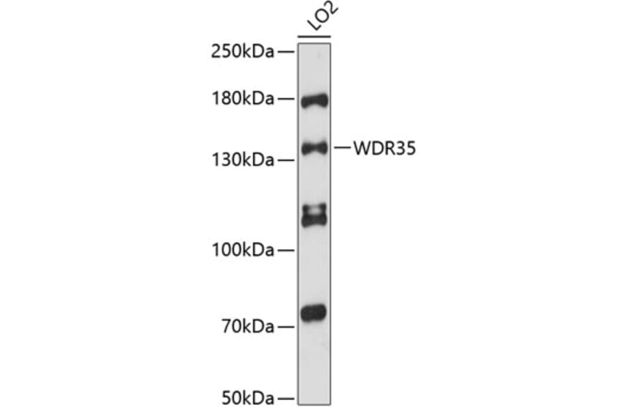 Western Blot - Anti-WDR35 Antibody (A88176) - Antibodies.com