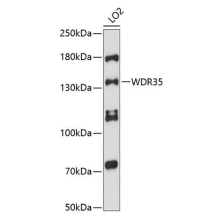 Western Blot - Anti-WDR35 Antibody (A88176) - Antibodies.com