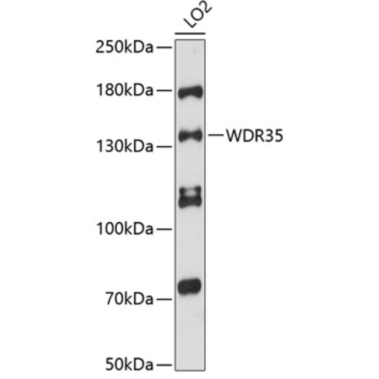Western Blot - Anti-WDR35 Antibody (A88176) - Antibodies.com