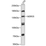 Western Blot - Anti-WDR35 Antibody (A88176) - Antibodies.com