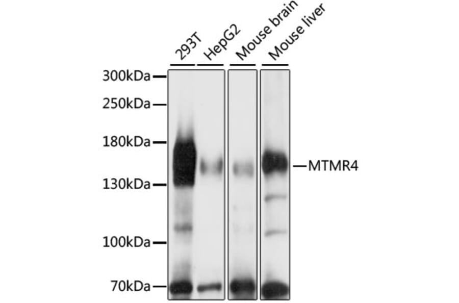 Western Blot - Anti-MTMR4 Antibody (A88177) - Antibodies.com