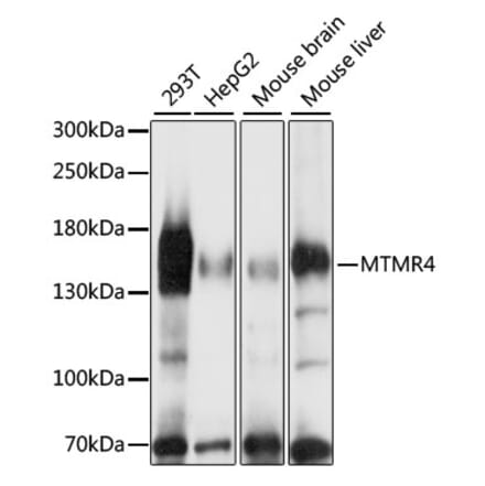 Western Blot - Anti-MTMR4 Antibody (A88177) - Antibodies.com