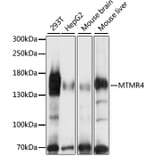 Western Blot - Anti-MTMR4 Antibody (A88177) - Antibodies.com