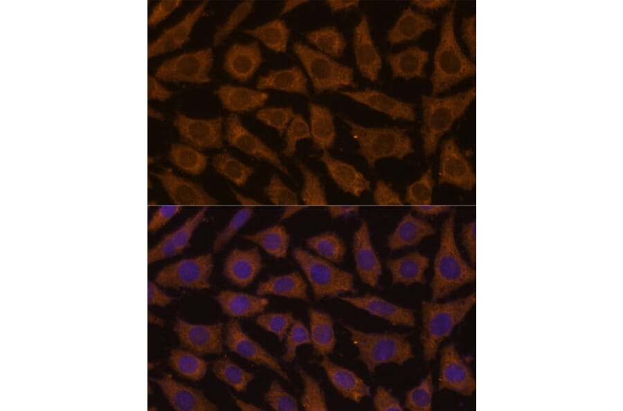 Immunofluorescence - Anti-MTMR4 Antibody (A88177) - Antibodies.com