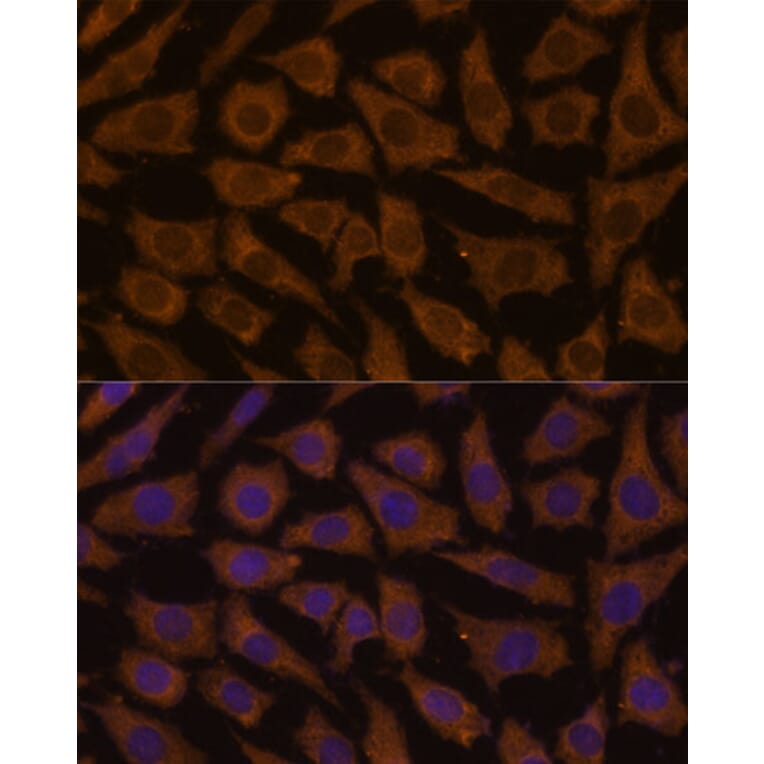 Immunofluorescence - Anti-MTMR4 Antibody (A88177) - Antibodies.com