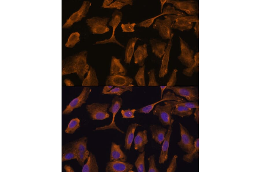 Immunofluorescence - Anti-MTMR4 Antibody (A88177) - Antibodies.com