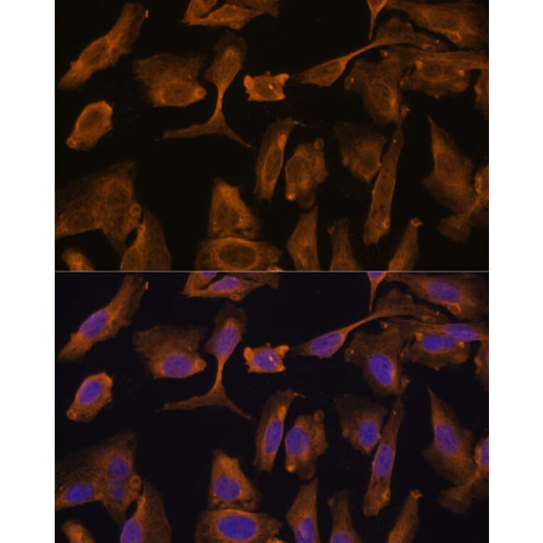 Immunofluorescence - Anti-MTMR4 Antibody (A88177) - Antibodies.com