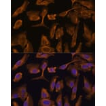 Immunofluorescence - Anti-MTMR4 Antibody (A88177) - Antibodies.com