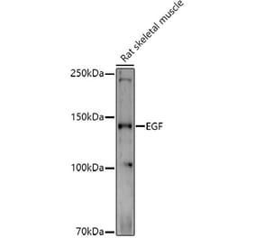Western Blot - Anti-EGF Antibody (A88178) - Antibodies.com