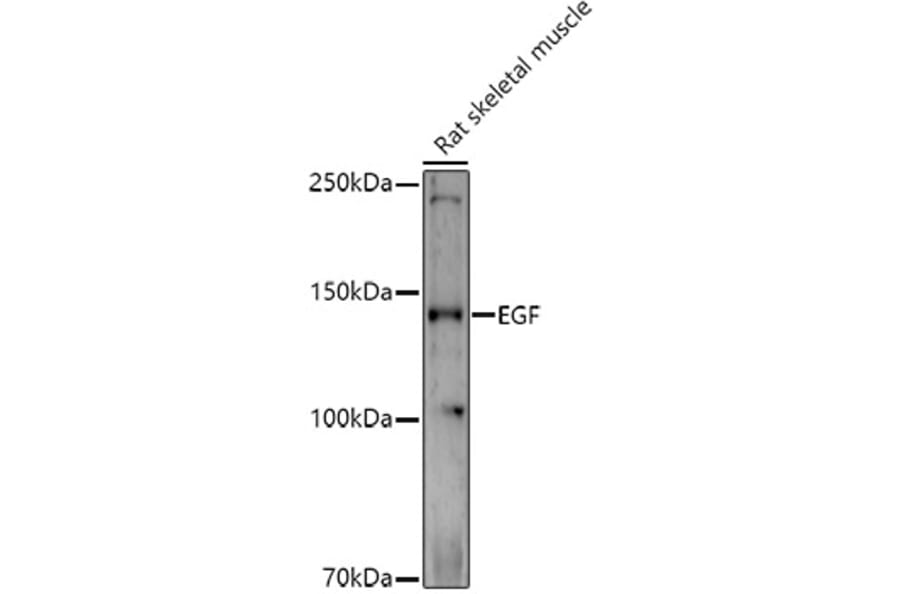Western Blot - Anti-EGF Antibody (A88178) - Antibodies.com