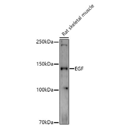 Western Blot - Anti-EGF Antibody (A88178) - Antibodies.com