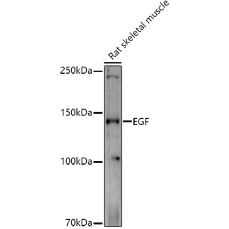 Western Blot - Anti-EGF Antibody (A88178) - Antibodies.com