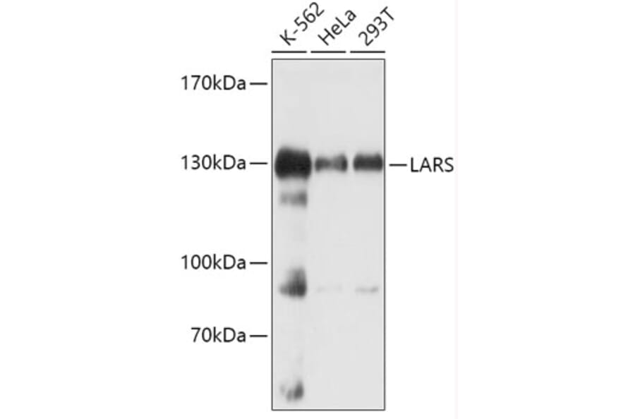 Western Blot - Anti-LeuRS Antibody (A88179) - Antibodies.com