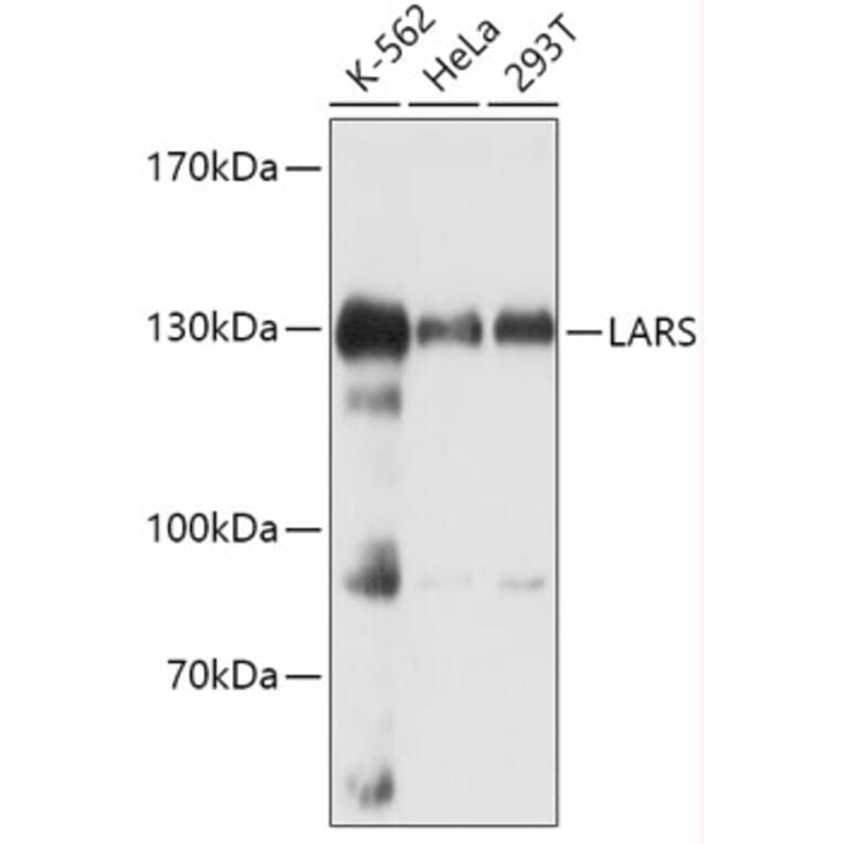 Western Blot - Anti-LeuRS Antibody (A88179) - Antibodies.com