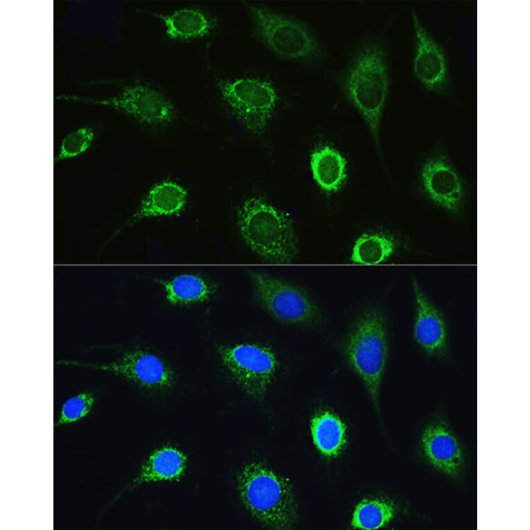 Immunofluorescence - Anti-LeuRS Antibody (A88179) - Antibodies.com