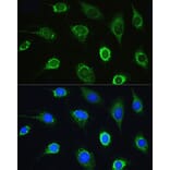 Immunofluorescence - Anti-LeuRS Antibody (A88179) - Antibodies.com