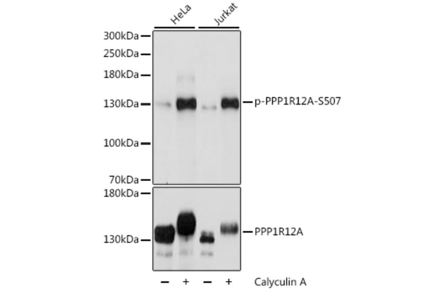 Western Blot - Anti-Myosin Phosphatase (phospho Ser507) Antibody (A88181) - Antibodies.com