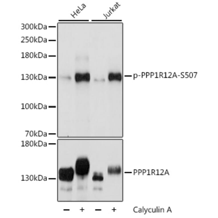 Western Blot - Anti-Myosin Phosphatase (phospho Ser507) Antibody (A88181) - Antibodies.com