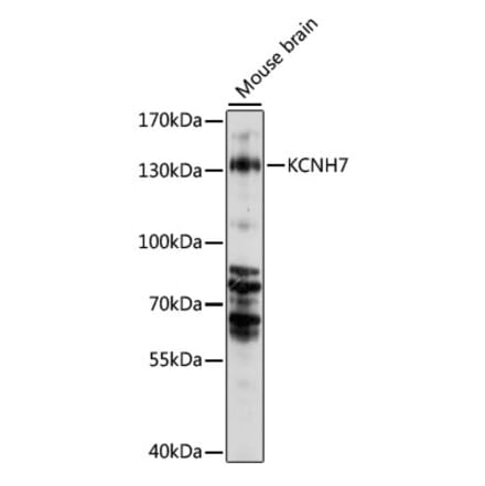 Western Blot - Anti-KCNH7 Antibody (A88182) - Antibodies.com
